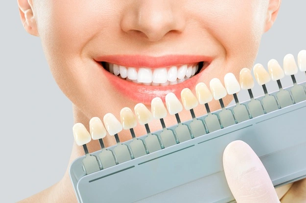 Cosmetic Dentist London: A Gateway to Smile Enhancement